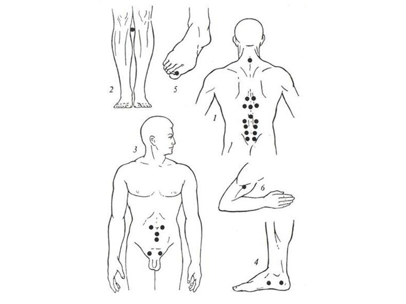 Acupuncture massage