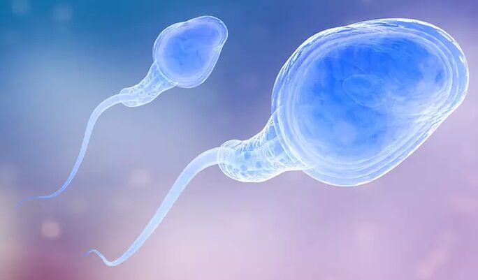 Sperm can be present in a man's pre-ejaculate